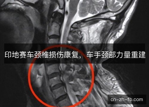 印地赛车颈椎损伤康复,车手颈部力量重建 印地赛车颈椎损伤康复,车手颈部力量重建